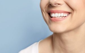 Achieving the Shiny Teeth: What You Need to Know About Teeth Whitening