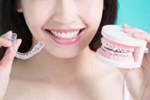 clear aligners