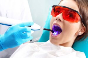 Restoration and filling of teeth with laser