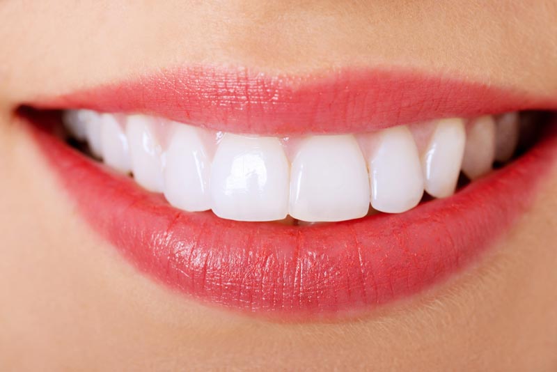 best dentist for veneers