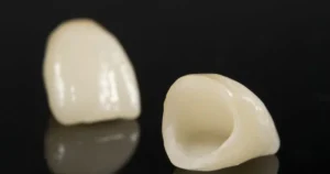 a picture of Dental Crowns