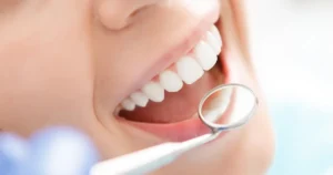 A picture of a white set of teeth